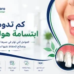 كم تدوم ابتسامة هوليوود