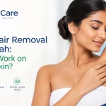 laser hair removal in Sharjah